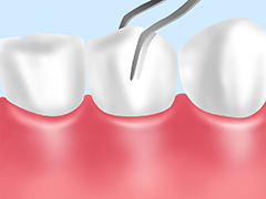 歯周病検査